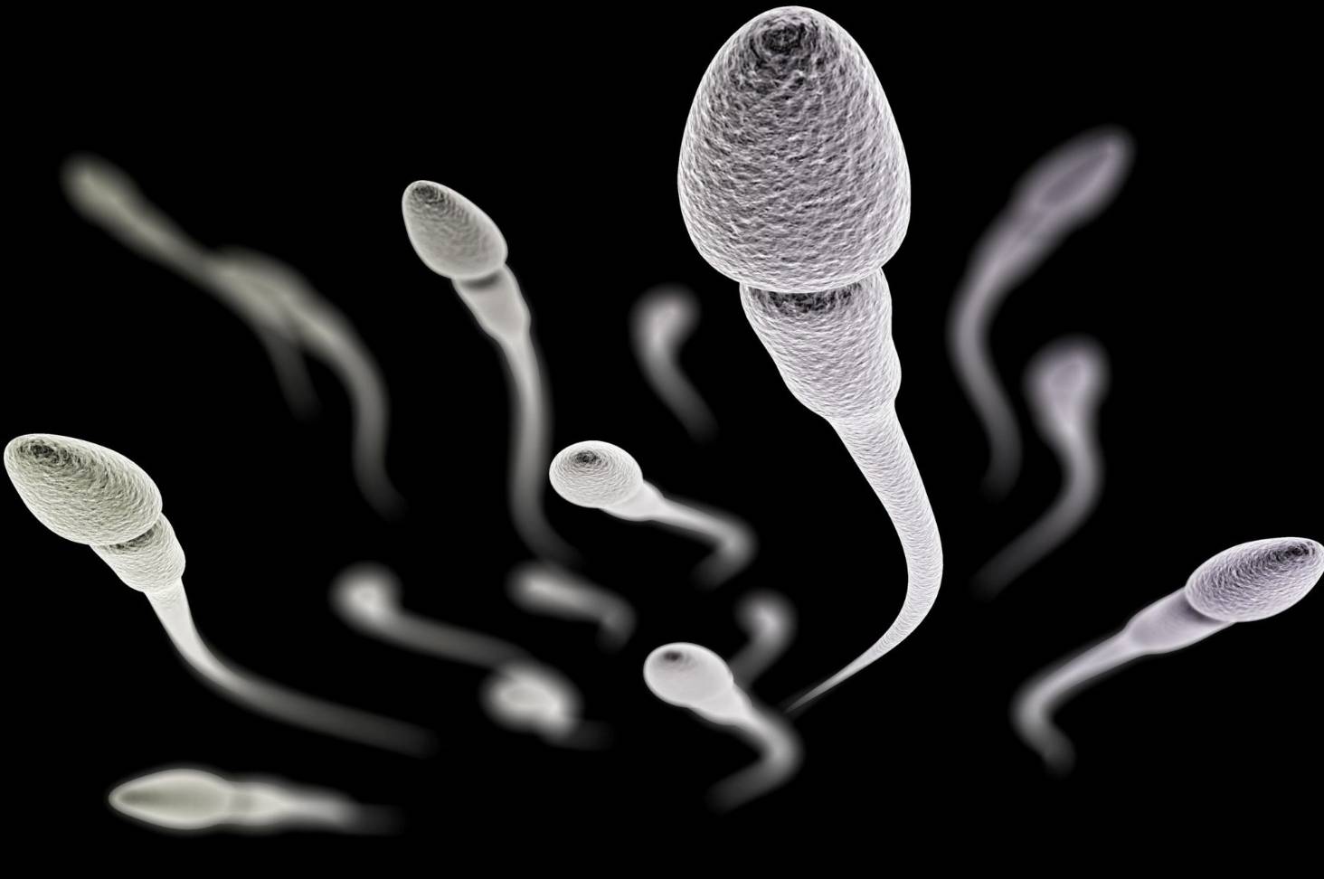 An In-Depth Guide On Pyospermia: Symptoms, Causes & Treatment