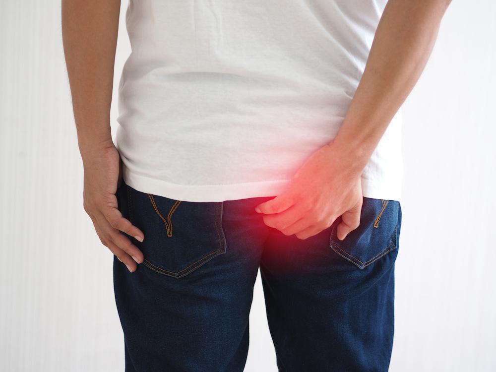 Will An External Hemorrhoid Go Away Doctor Omar Chughtai 9607