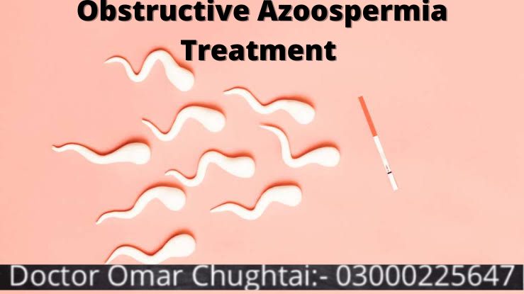 Obstructive Azoospermia Treatment | No Sperm Count | Mardana Banjhpan