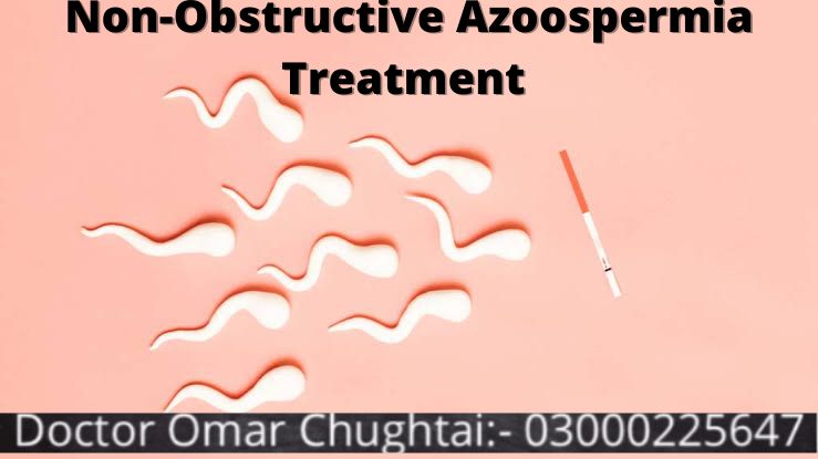 Non Obstructive Azoospermia Treatment | No-Sperm Count