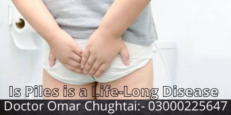 Is Piles is a Life-Long Disease