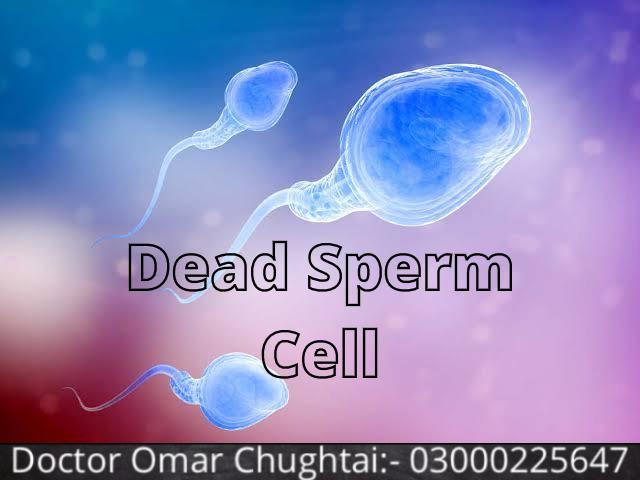﻿Dead Sperm Cell | What Causes Azoospermia | Murda Sperm Cell