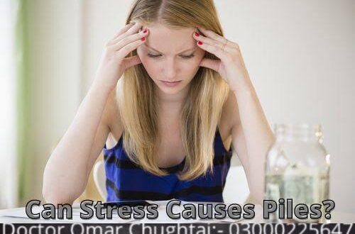 Can stress cause piles? | Kiya Tnao Bawaseer Ka Sabab Ban Sakta Ha