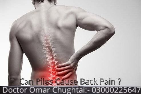 Can Piles Cause Back Pain? | Kiya Bawaseer Kamar Dard Ka Sabab Ha
