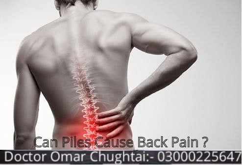 Can Piles Cause Back Pain? | Kiya Bawaseer Kamar Dard Ka Sabab Ha