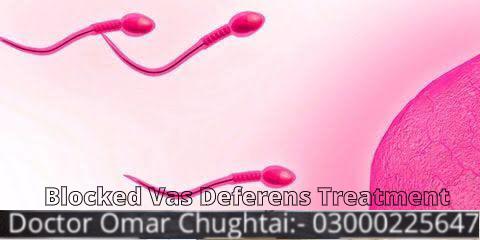 What Is Blocked Vas Deferens Treatment?