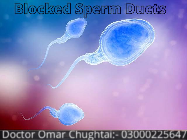 Blocked Sperm Ducts – EDO | Causes, Diagnosis and Treatment