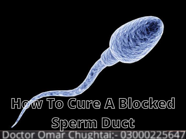 How to cure a blocked sperm duct?