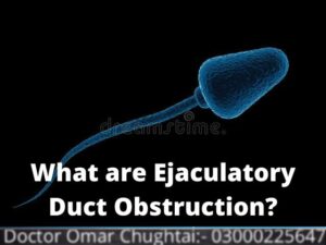 What are Ejaculatory Duct Obstruction?