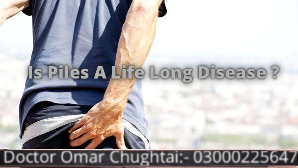 Is piles a lifelong disease? | Kiya Bawaseer Umer Bhar Ki Bimari Ha