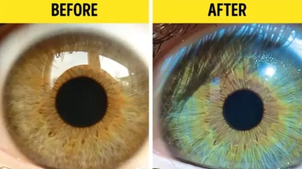 How To Change Eye Color To Blue Naturally With Food?