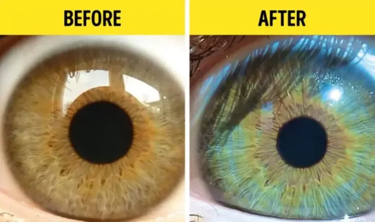 How to change eye color naturally with food?